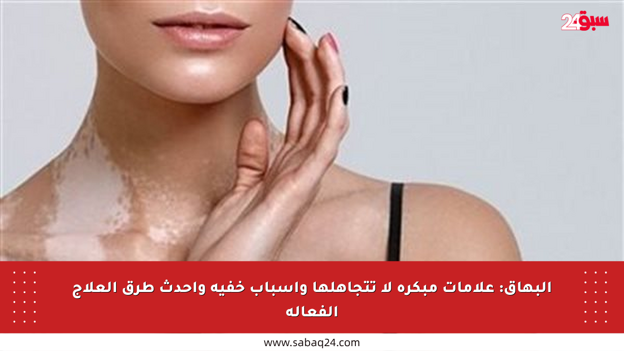البهاق: علامات مبكرة لا تتجاهلها وأسباب خفية وأحدث طرق العلاج الفعالة
